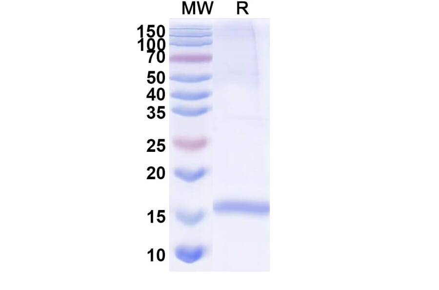 SDS-PAGE - Anti-Integrin alpha 3 Nanobody [SAA1303] (A337861) - Antibodies.com