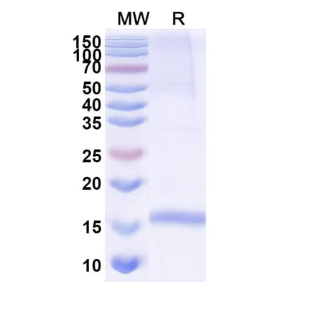 SDS-PAGE - Anti-Integrin alpha 3 Nanobody [SAA1303] (A337861) - Antibodies.com