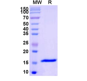 SDS-PAGE - Anti-GABRB3 Nanobody [SAA1162] (A337865) - Antibodies.com