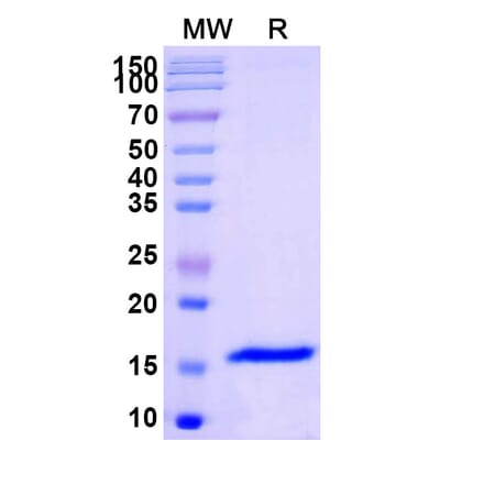 SDS-PAGE - Anti-GABRB3 Nanobody [SAA1162] (A337865) - Antibodies.com