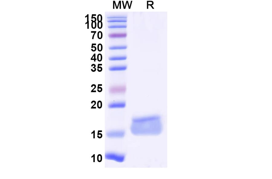 SDS-PAGE - Anti-ADORA2A Nanobody [SAA1155] (A337870) - Antibodies.com
