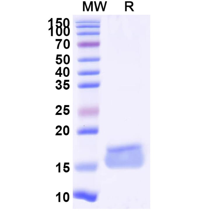 SDS-PAGE - Anti-ADORA2A Nanobody [SAA1155] (A337870) - Antibodies.com
