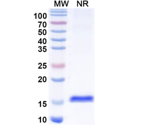 SDS-PAGE - Anti-CTGF Nanobody [SAA1211] (A337871) - Antibodies.com