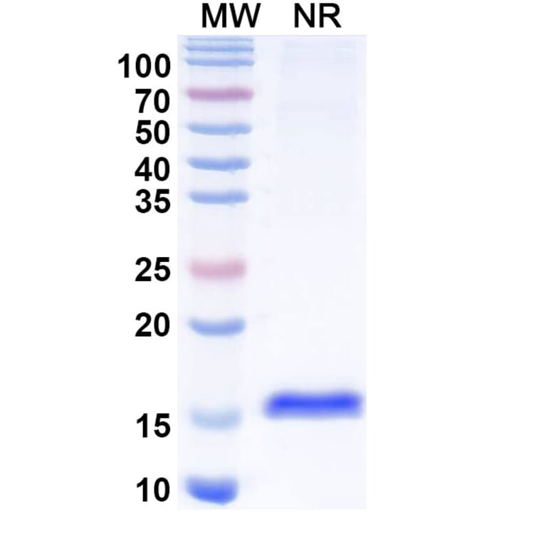 SDS-PAGE - Anti-CTGF Nanobody [SAA1211] (A337871) - Antibodies.com