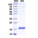 SDS-PAGE - Anti-CTGF Nanobody [SAA1211] (A337871) - Antibodies.com