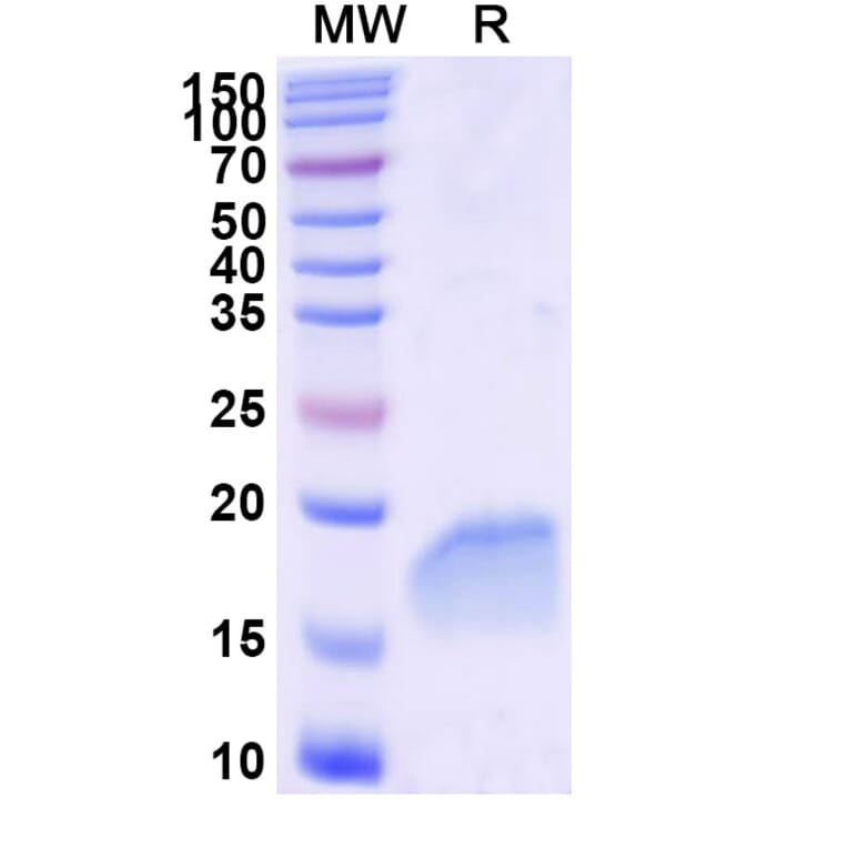 SDS-PAGE - Anti-AKT1 Nanobody [SAA1080] (A337876) - Antibodies.com