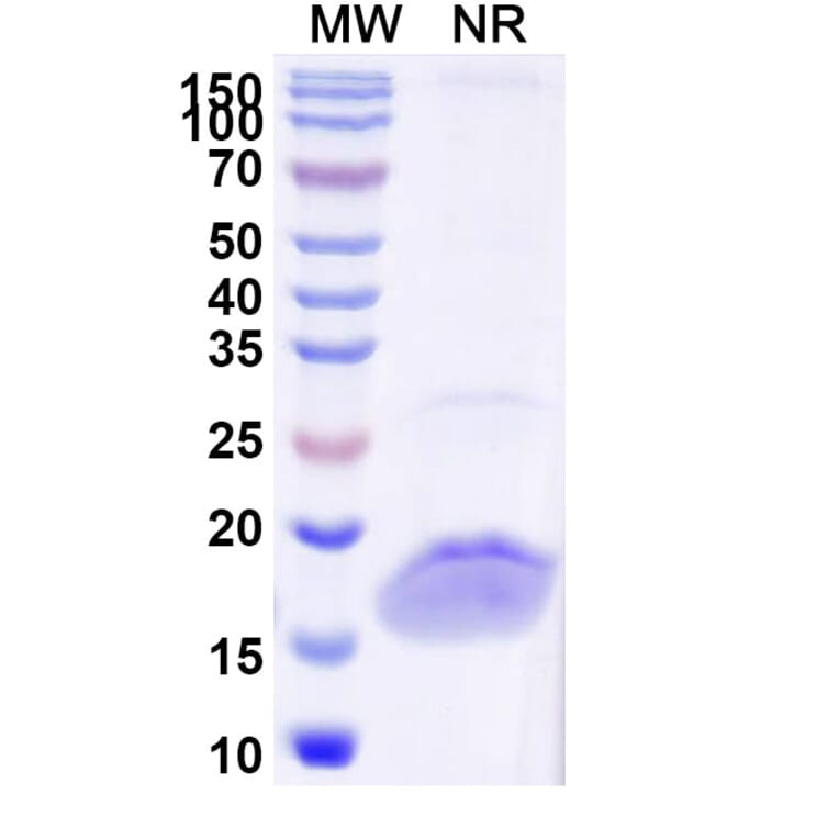 SDS-PAGE - Anti-CD32 Nanobody [SAA1313] (A337879) - Antibodies.com