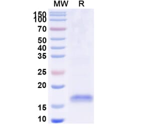 SDS-PAGE - Anti-MC4R Nanobody [SAA1276] (A337880) - Antibodies.com