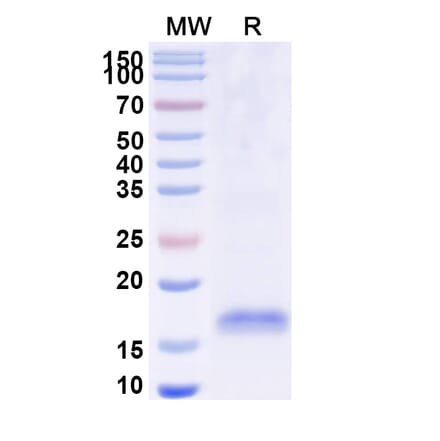 SDS-PAGE - Anti-MC4R Nanobody [SAA1276] (A337880) - Antibodies.com