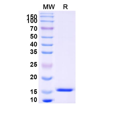 SDS-PAGE - Anti-EBI2 Nanobody [SAA0953] (A337882) - Antibodies.com