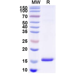 SDS-PAGE - Anti-EPHX2 Nanobody [SAA1372] (A337884) - Antibodies.com