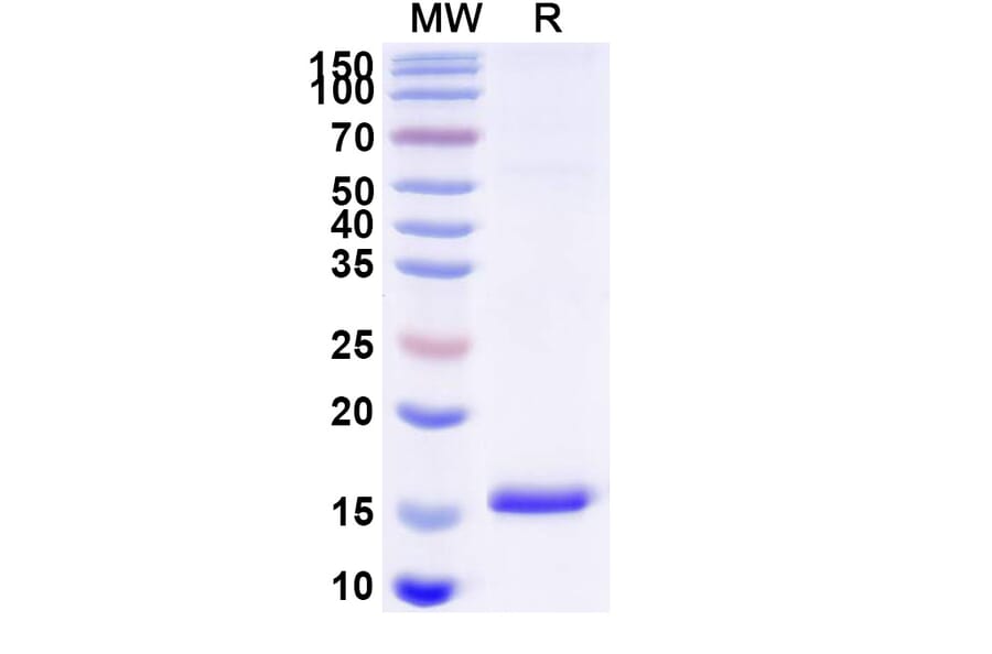 SDS-PAGE - Anti-EPHX2 Nanobody [SAA1372] (A337884) - Antibodies.com