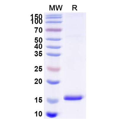 SDS-PAGE - Anti-EPHX2 Nanobody [SAA1372] (A337884) - Antibodies.com