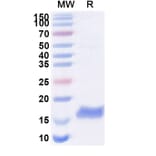 SDS-PAGE - Anti-beta Catenin Nanobody [SAA1188] (A337886) - Antibodies.com