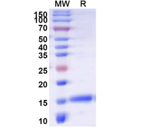 SDS-PAGE - Anti-APJ Nanobody [SAA1115] (A337888) - Antibodies.com