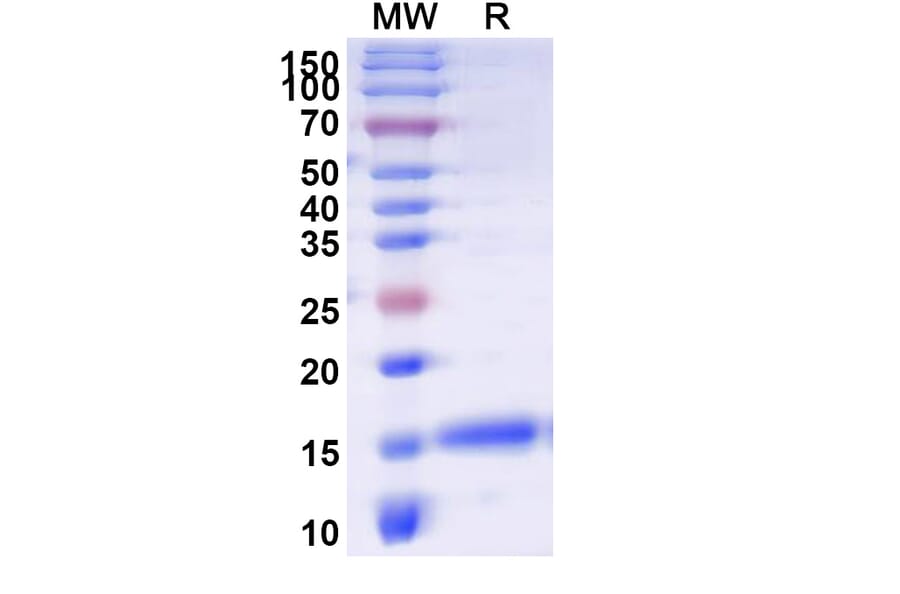 SDS-PAGE - Anti-APJ Nanobody [SAA1115] (A337888) - Antibodies.com