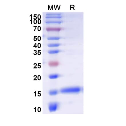 SDS-PAGE - Anti-APJ Nanobody [SAA1115] (A337888) - Antibodies.com