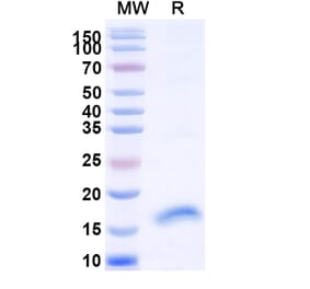 SDS-PAGE - Anti-FLT3 Nanobody [SAA1328] (A337891) - Antibodies.com