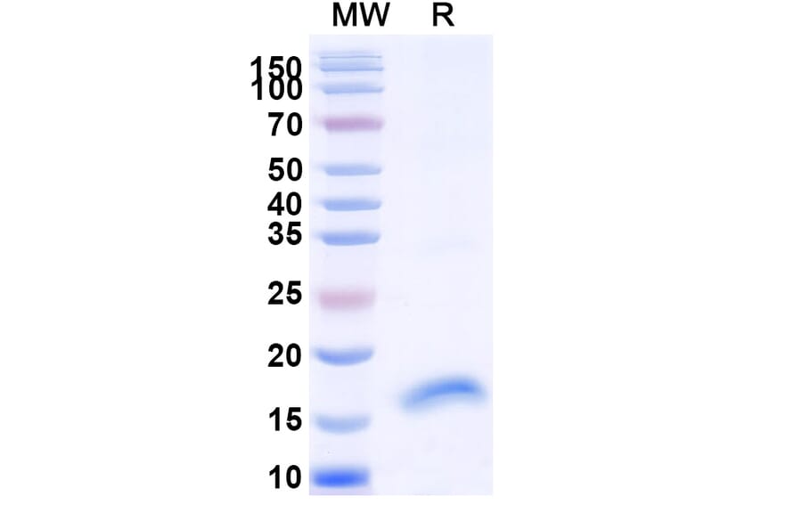SDS-PAGE - Anti-FLT3 Nanobody [SAA1328] (A337891) - Antibodies.com