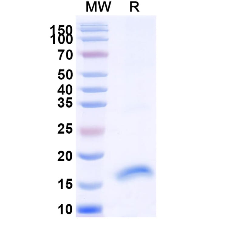 SDS-PAGE - Anti-FLT3 Nanobody [SAA1328] (A337891) - Antibodies.com