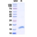 SDS-PAGE - Anti-FLT3 Nanobody [SAA1328] (A337891) - Antibodies.com