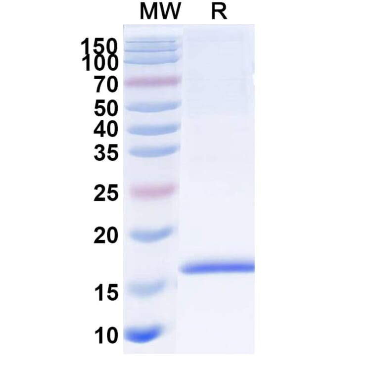 SDS-PAGE - Anti-MMP12 Nanobody [SAA1293] (A337893) - Antibodies.com