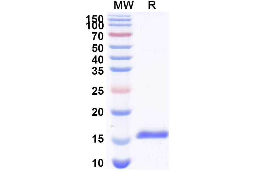SDS-PAGE - Anti-CaSR Nanobody [SAA1046] (A337896) - Antibodies.com