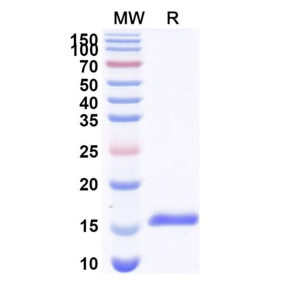 SDS-PAGE - Anti-CaSR Nanobody [SAA1046] (A337896) - Antibodies.com