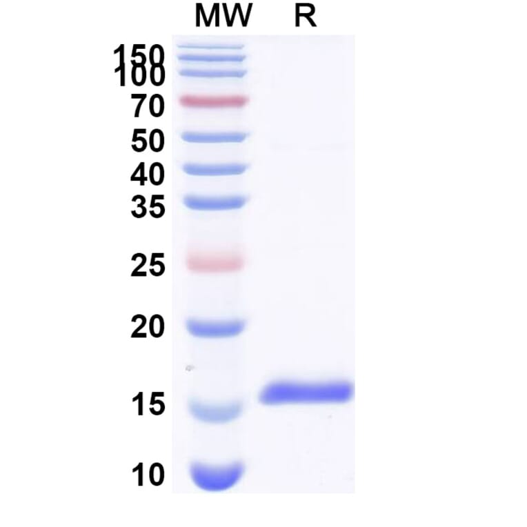 SDS-PAGE - Anti-CaSR Nanobody [SAA1046] (A337896) - Antibodies.com