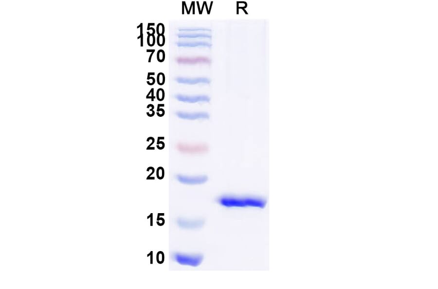 SDS-PAGE - Anti-mGluR5 Nanobody [SAA1251] (A337897) - Antibodies.com