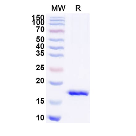 SDS-PAGE - Anti-mGluR5 Nanobody [SAA1251] (A337897) - Antibodies.com