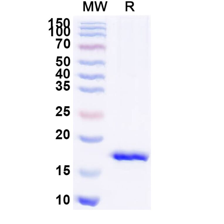 SDS-PAGE - Anti-mGluR5 Nanobody [SAA1251] (A337897) - Antibodies.com