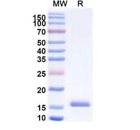 SDS-PAGE - Anti-mGluR5 Nanobody [SAA1086] (A337898) - Antibodies.com