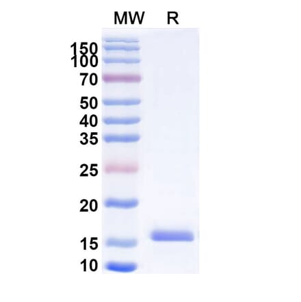 SDS-PAGE - Anti-mGluR5 Nanobody [SAA1086] (A337898) - Antibodies.com