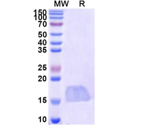 SDS-PAGE - Anti-Caspase-3 Nanobody [SAA1223] (A337900) - Antibodies.com