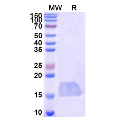 SDS-PAGE - Anti-Caspase-3 Nanobody [SAA1223] (A337900) - Antibodies.com