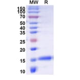 SDS-PAGE - Anti-DPP6 Nanobody [SAA1245] (A337901) - Antibodies.com
