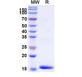 SDS-PAGE - Anti-IL-12RB1 Nanobody [SAA1300] (A337902) - Antibodies.com