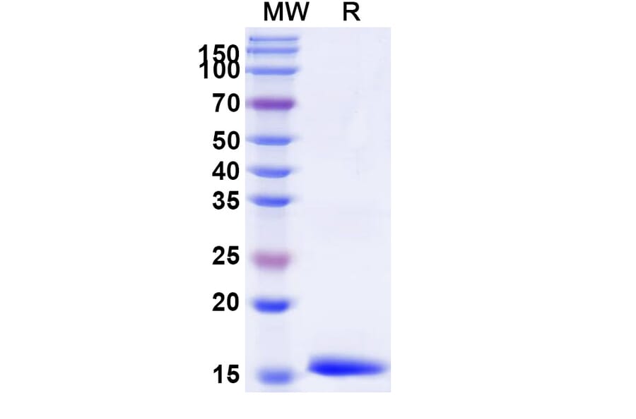 SDS-PAGE - Anti-IL-12RB1 Nanobody [SAA1300] (A337902) - Antibodies.com