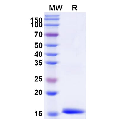 SDS-PAGE - Anti-IL-12RB1 Nanobody [SAA1300] (A337902) - Antibodies.com