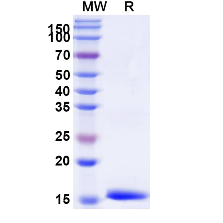 SDS-PAGE - Anti-IL-12RB1 Nanobody [SAA1300] (A337902) - Antibodies.com
