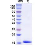 SDS-PAGE - Anti-IL-12RB1 Nanobody [SAA1300] (A337902) - Antibodies.com