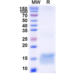 SDS-PAGE - Anti-Huntingtin Nanobody [SAA1178] (A337903) - Antibodies.com