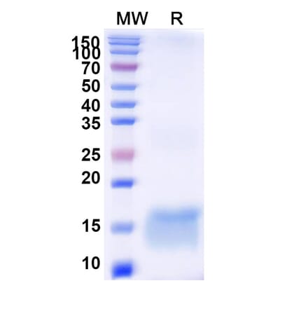 SDS-PAGE - Anti-Huntingtin Nanobody [SAA1178] (A337903) - Antibodies.com