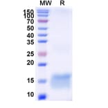 SDS-PAGE - Anti-Huntingtin Nanobody [SAA1178] (A337903) - Antibodies.com