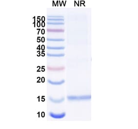 SDS-PAGE - Anti-Huntingtin Nanobody [SAA1032] (A337904) - Antibodies.com