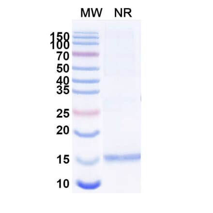 SDS-PAGE - Anti-Huntingtin Nanobody [SAA1032] (A337904) - Antibodies.com
