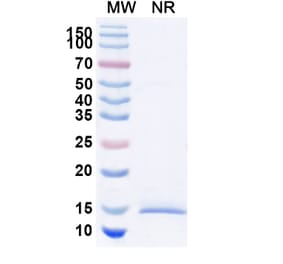 SDS-PAGE - Anti-Huntingtin Nanobody [SAA1033] (A337905) - Antibodies.com