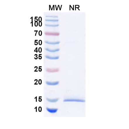SDS-PAGE - Anti-Huntingtin Nanobody [SAA1033] (A337905) - Antibodies.com
