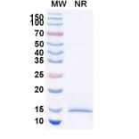 SDS-PAGE - Anti-Huntingtin Nanobody [SAA1033] (A337905) - Antibodies.com